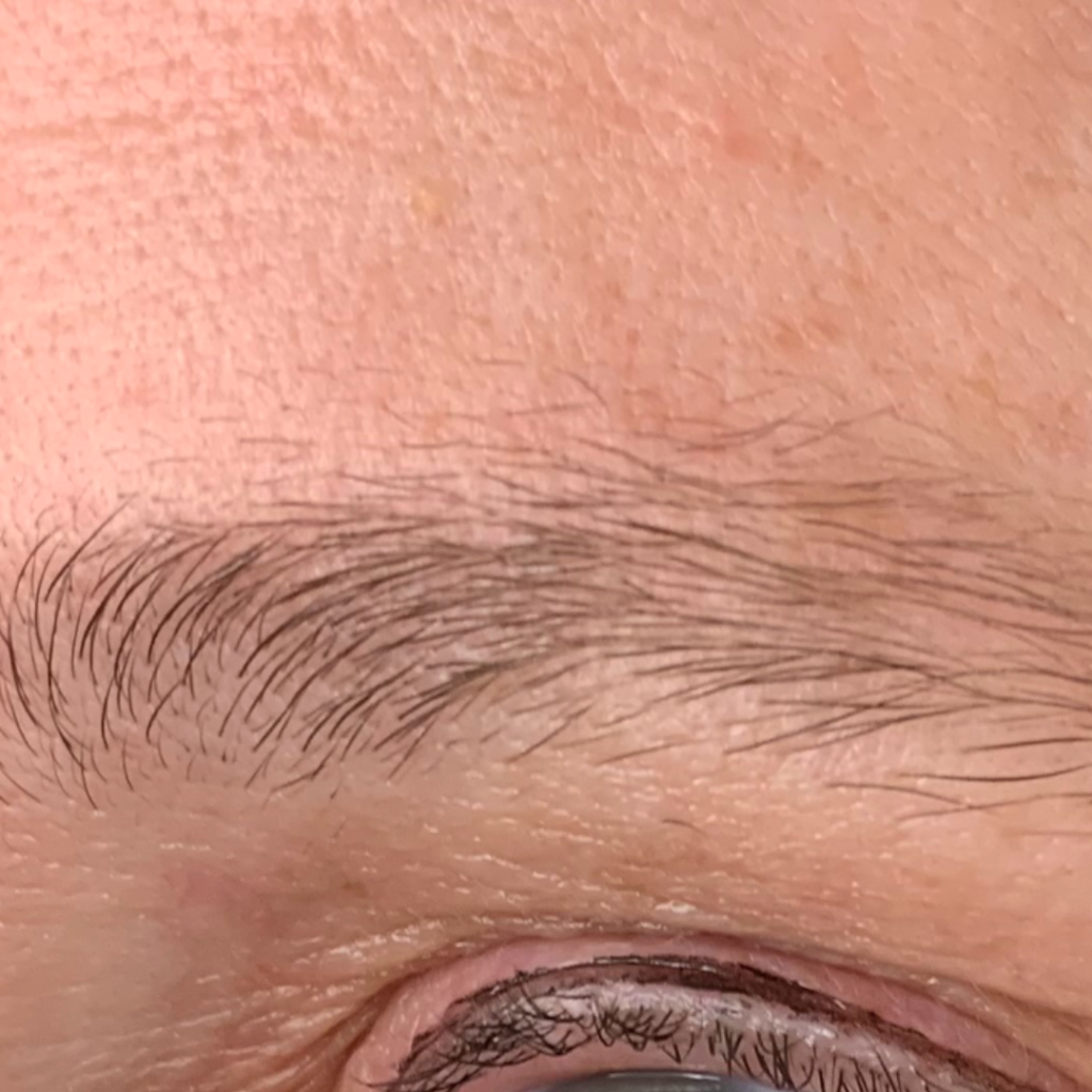 Brows 1BH_BEFORE