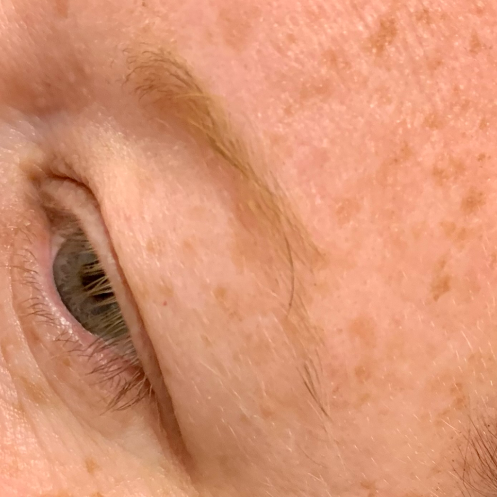 Brows 2_BEFORE